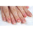 Silk'n Micro-Nail